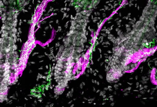 Hair follicle with muscle (magenta) and nerve (green) interaction (Image by Yulia Shwartz)