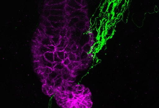 Sympathetic nerves (green) and hair follicle stem cells (magenta) (Image by Yulia Shwartz)