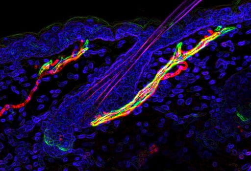 Hair follicle with muscle (green) and nerve (red) interaction (Image by Yulia Shwartz)